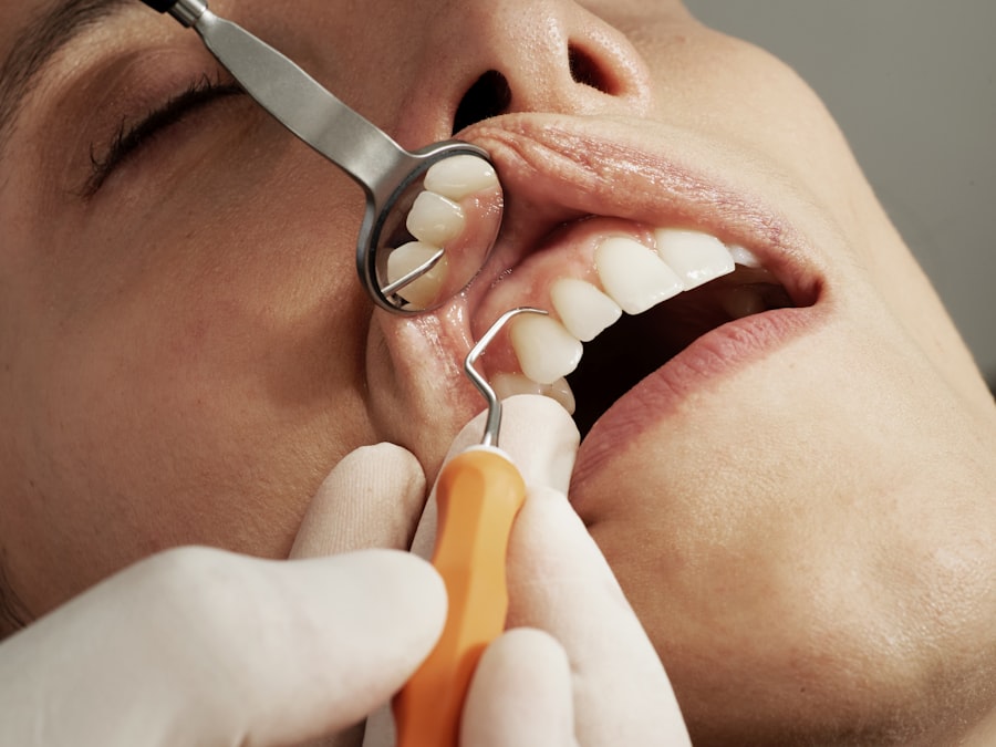 Revisión dental con instrumental